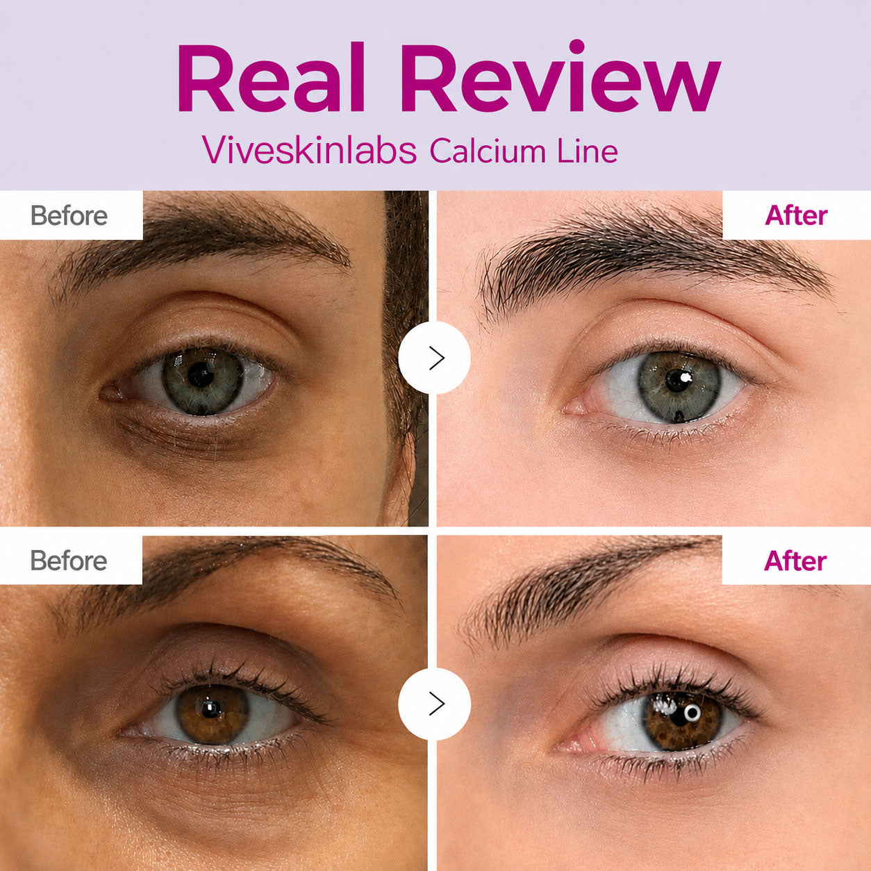 🔥LAST DAY 50% OFF!!Viveskinlabs Korean Calcium Dark Spot Eye Cream