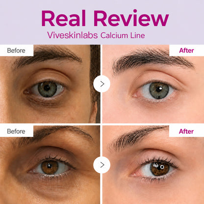 🔥LAST DAY 50% OFF!!Viveskinlabs Korean Calcium Dark Spot Eye Cream