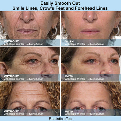 Viveskinlabs Instant Face Temporary Tightener – Instant visible results in 30 seconds