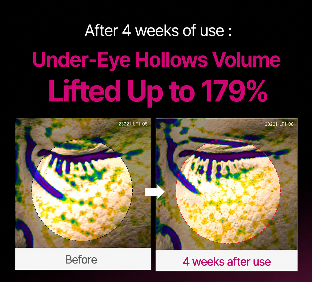 🔥LAST DAY 50% OFF!!Viveskinlabs Korean Calcium Dark Spot Eye Cream